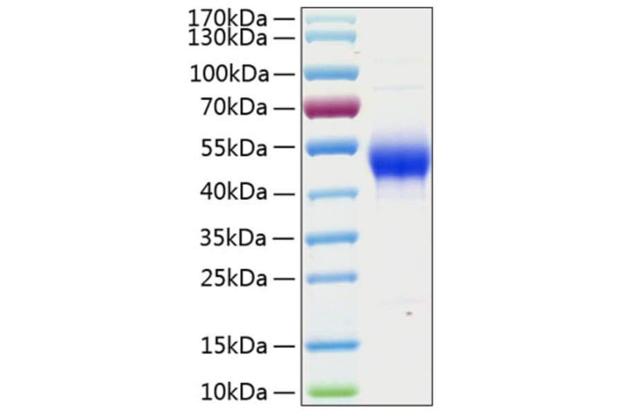 SDS-PAGE - Recombinant Human CD14 Protein (C-terminal His Tag) (A330232) - Antibodies.com