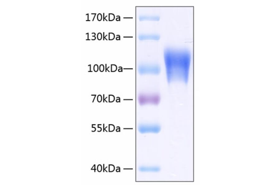 SDS-PAGE - Recombinant Human CD146 Protein (C-terminal His Tag) (A330233) - Antibodies.com