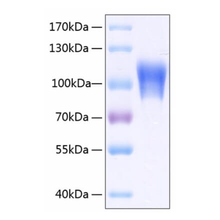SDS-PAGE - Recombinant Human CD146 Protein (C-terminal His Tag) (A330233) - Antibodies.com