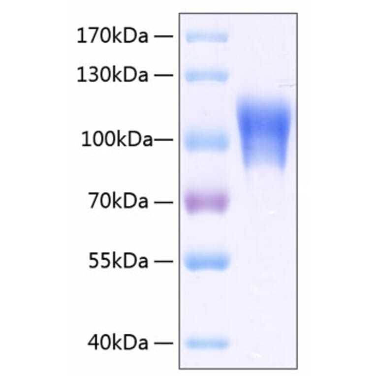 SDS-PAGE - Recombinant Human CD146 Protein (C-terminal His Tag) (A330233) - Antibodies.com