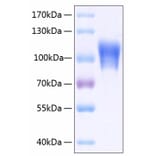 SDS-PAGE - Recombinant Human CD146 Protein (C-terminal His Tag) (A330233) - Antibodies.com