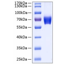 SDS-PAGE - Recombinant Human CD147 Protein (C-terminal Human Fc and His Tag) (A330234) - Antibodies.com