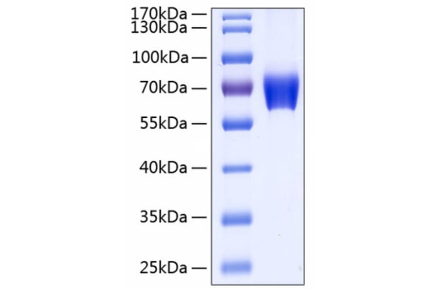 SDS-PAGE - Recombinant Human CD147 Protein (C-terminal Human Fc and His Tag) (A330234) - Antibodies.com