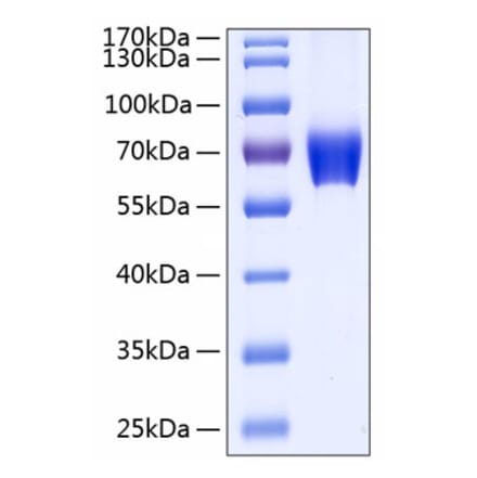 SDS-PAGE - Recombinant Human CD147 Protein (C-terminal Human Fc and His Tag) (A330234) - Antibodies.com