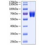 SDS-PAGE - Recombinant Human CD147 Protein (C-terminal Human Fc and His Tag) (A330234) - Antibodies.com