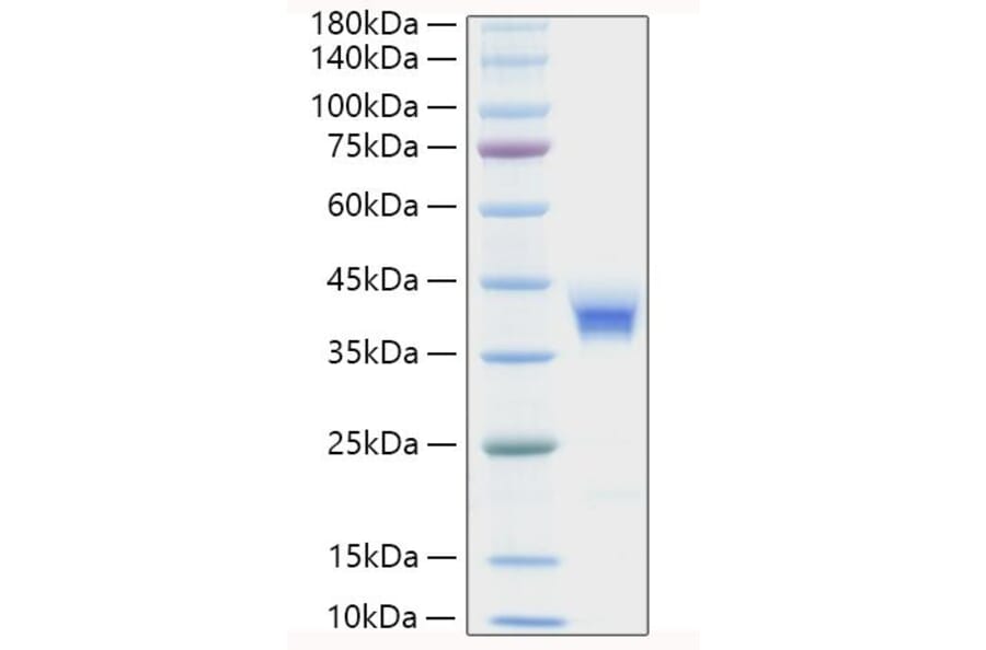 SDS-PAGE - Recombinant Human CD157 Protein (C-terminal His Tag) (A330235) - Antibodies.com