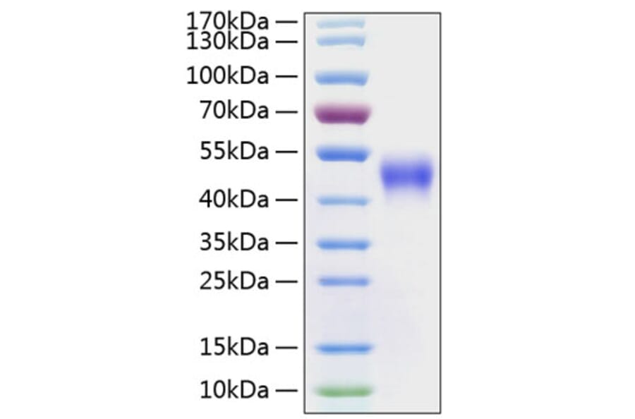 SDS-PAGE - Recombinant Human CD16 Protein (C-terminal His Tag) (A330236) - Antibodies.com