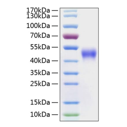 SDS-PAGE - Recombinant Human CD16 Protein (C-terminal His Tag) (A330236) - Antibodies.com