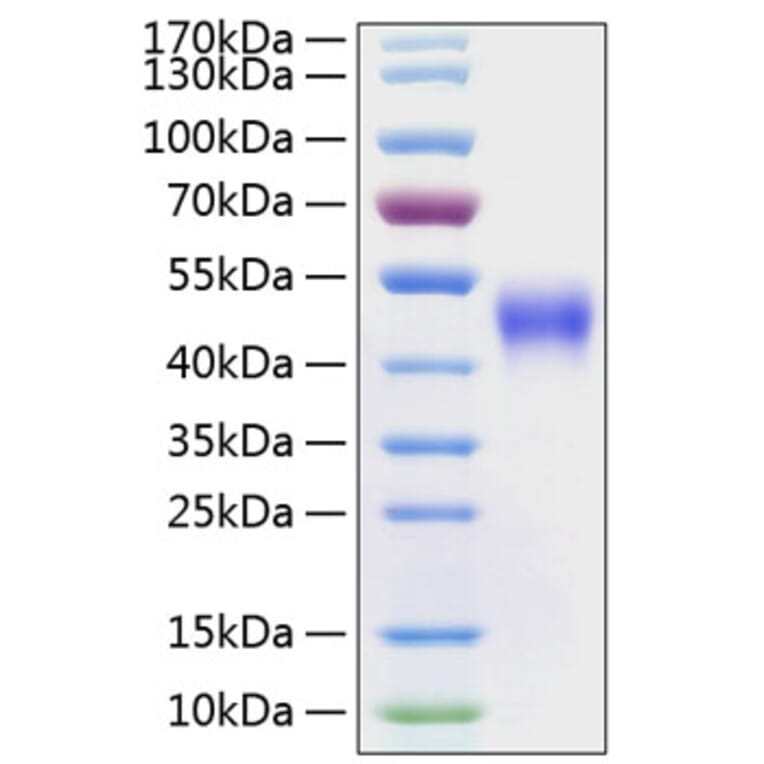 SDS-PAGE - Recombinant Human CD16 Protein (C-terminal His Tag) (A330236) - Antibodies.com