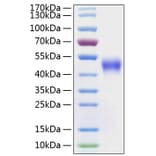 SDS-PAGE - Recombinant Human CD16 Protein (C-terminal His Tag) (A330236) - Antibodies.com