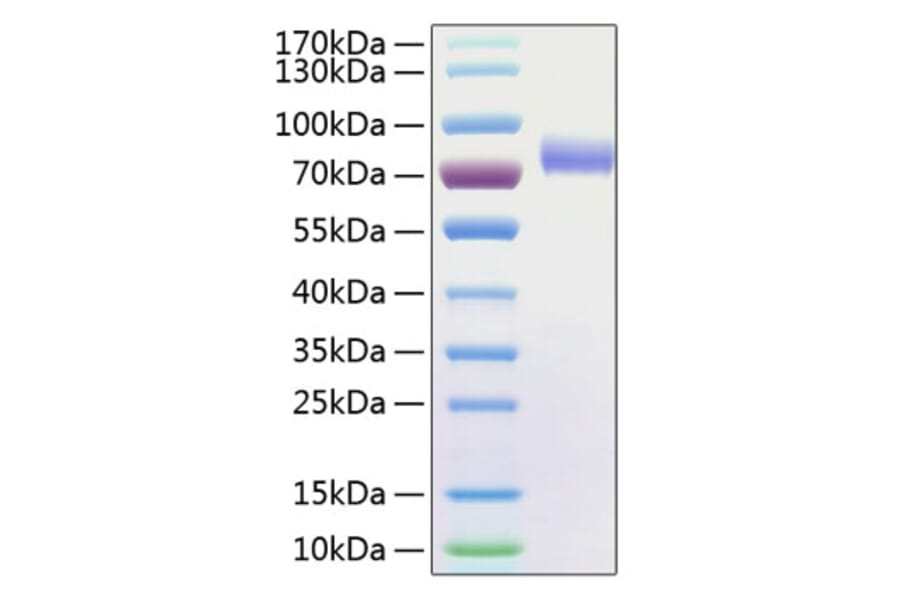 SDS-PAGE - Recombinant Human CD16 Protein (C-terminal Human Fc and His Tag) (A330237) - Antibodies.com