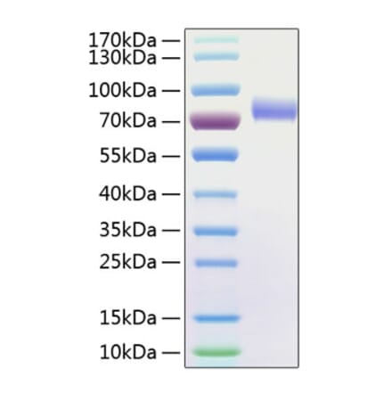 SDS-PAGE - Recombinant Human CD16 Protein (C-terminal Human Fc and His Tag) (A330237) - Antibodies.com