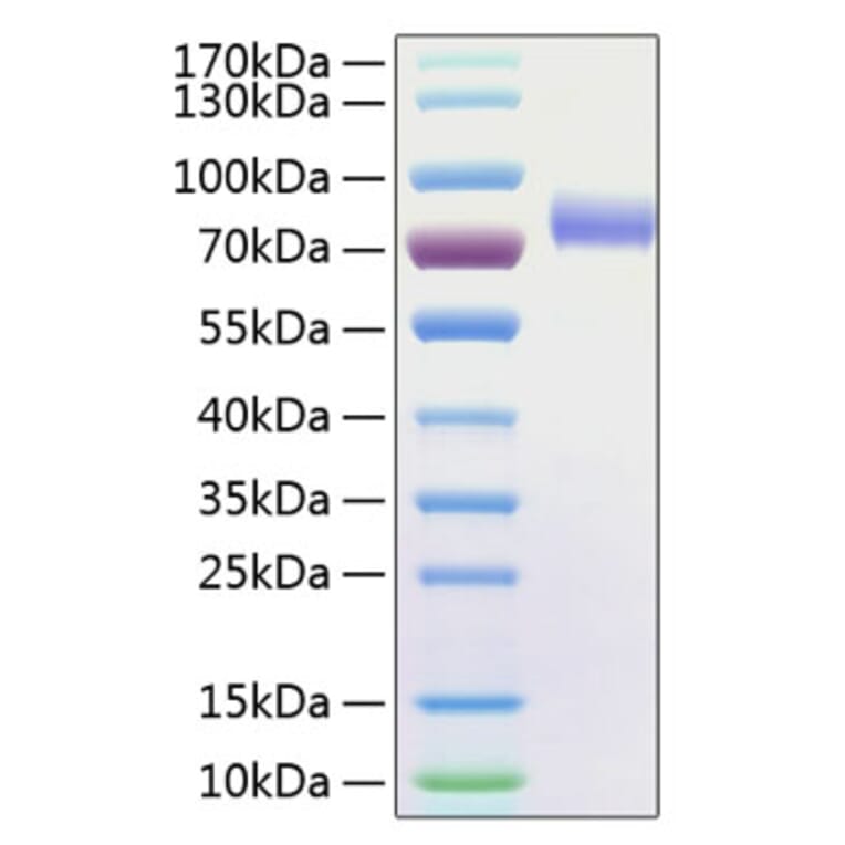 SDS-PAGE - Recombinant Human CD16 Protein (C-terminal Human Fc and His Tag) (A330237) - Antibodies.com