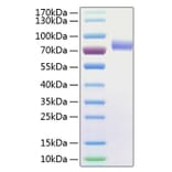 SDS-PAGE - Recombinant Human CD16 Protein (C-terminal Human Fc and His Tag) (A330237) - Antibodies.com