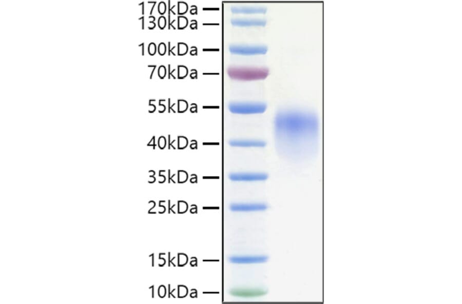 SDS-PAGE - Recombinant Human CD16 Protein (C-terminal His Tag) (A330238) - Antibodies.com