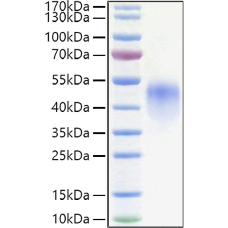 SDS-PAGE - Recombinant Human CD16 Protein (C-terminal His Tag) (A330238) - Antibodies.com