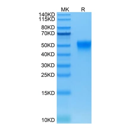 Tris-Bis PAGE - Recombinant Human CD16 Protein (Biotin) (C-terminal His and Avi Tag) (A330239) - Antibodies.com