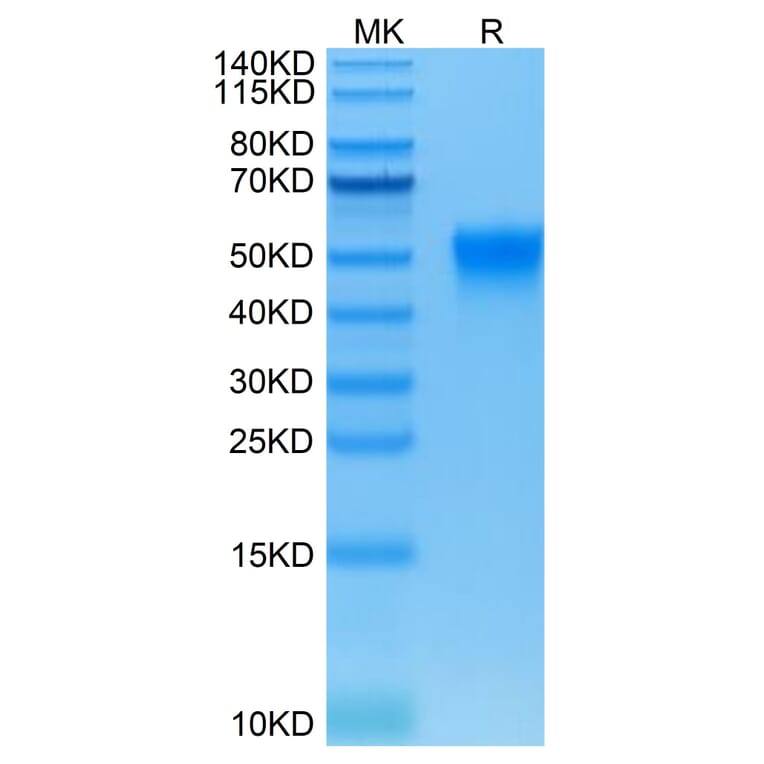 Tris-Bis PAGE - Recombinant Human CD16 Protein (Biotin) (C-terminal His and Avi Tag) (A330239) - Antibodies.com