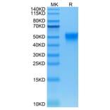 Tris-Bis PAGE - Recombinant Human CD16 Protein (Biotin) (C-terminal His and Avi Tag) (A330239) - Antibodies.com
