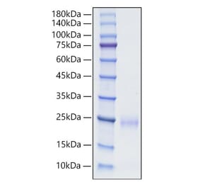 SDS-PAGE - Recombinant Human CD160 Protein (C-terminal His Tag) (A330240) - Antibodies.com