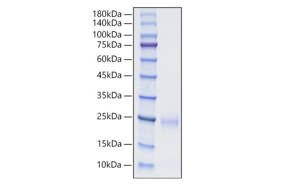 SDS-PAGE - Recombinant Human CD160 Protein (C-terminal His Tag) (A330240) - Antibodies.com