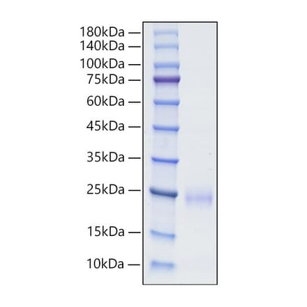 SDS-PAGE - Recombinant Human CD160 Protein (C-terminal His Tag) (A330240) - Antibodies.com
