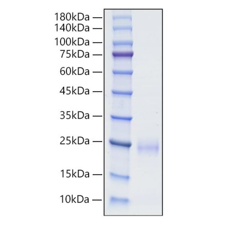 SDS-PAGE - Recombinant Human CD160 Protein (C-terminal His Tag) (A330240) - Antibodies.com