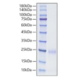 SDS-PAGE - Recombinant Human CD160 Protein (C-terminal His Tag) (A330240) - Antibodies.com