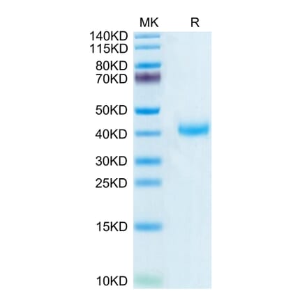 Tris-Bis PAGE - Recombinant Human CD161 Protein (Biotin) (C-terminal His and Avi Tag) (A330241) - Antibodies.com