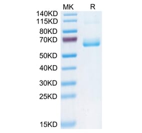 Tris-Bis PAGE - Recombinant Human CD161 Protein (C-terminal Human Fc Tag) (A330242) - Antibodies.com