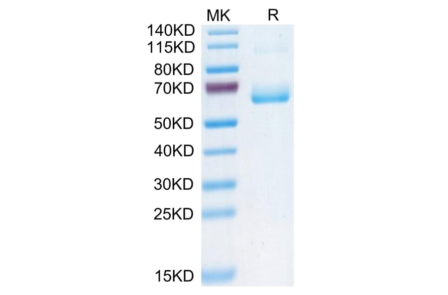 Tris-Bis PAGE - Recombinant Human CD161 Protein (C-terminal Human Fc Tag) (A330242) - Antibodies.com