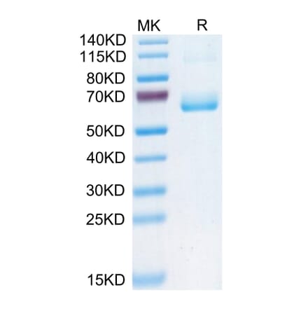 Tris-Bis PAGE - Recombinant Human CD161 Protein (C-terminal Human Fc Tag) (A330242) - Antibodies.com