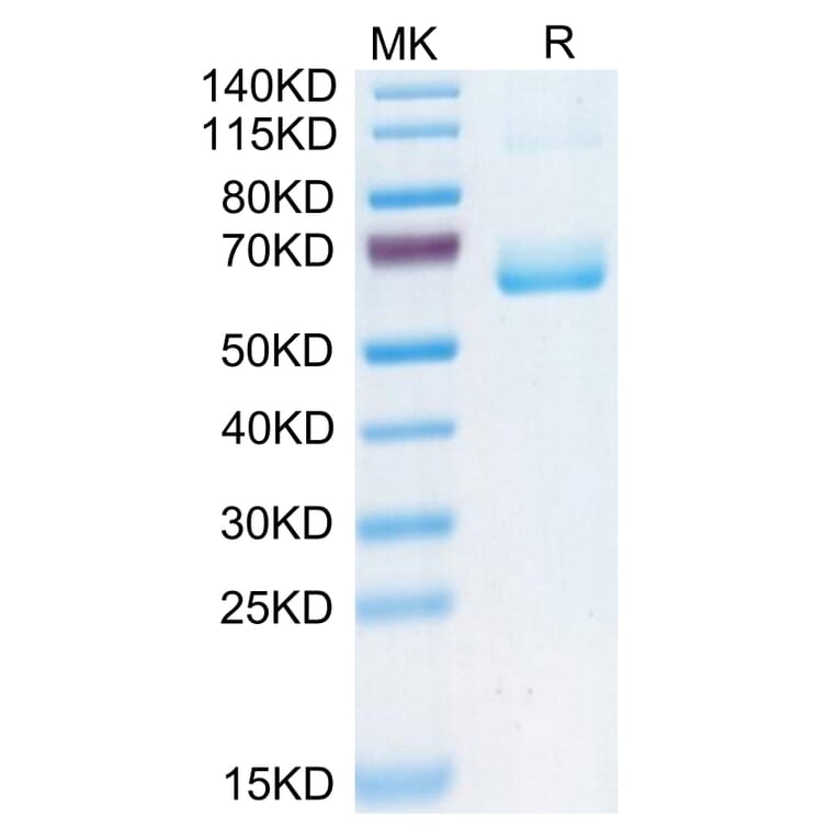 Tris-Bis PAGE - Recombinant Human CD161 Protein (C-terminal Human Fc Tag) (A330242) - Antibodies.com