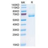 Tris-Bis PAGE - Recombinant Human CD161 Protein (C-terminal Human Fc Tag) (A330242) - Antibodies.com
