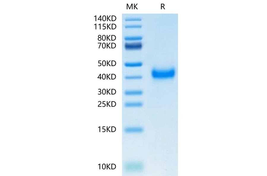 Tris-Bis PAGE - Recombinant Human CD161 Protein (C-terminal His Tag) (A330243) - Antibodies.com