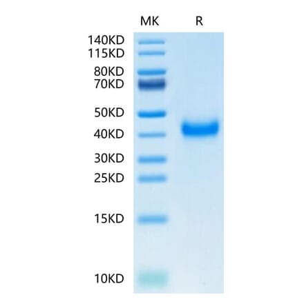 Tris-Bis PAGE - Recombinant Human CD161 Protein (C-terminal His Tag) (A330243) - Antibodies.com