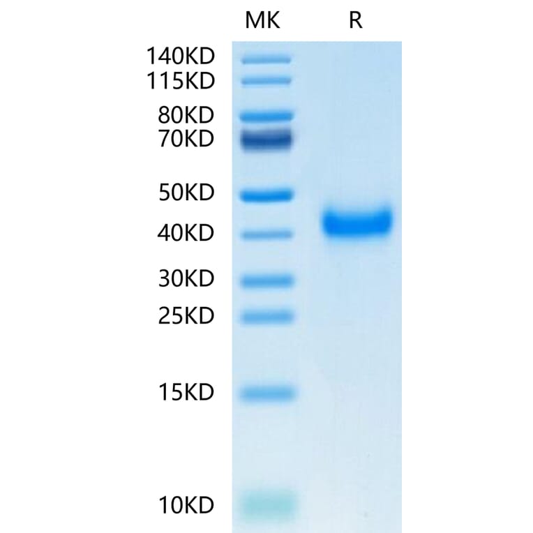 Tris-Bis PAGE - Recombinant Human CD161 Protein (C-terminal His Tag) (A330243) - Antibodies.com