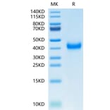 Tris-Bis PAGE - Recombinant Human CD161 Protein (C-terminal His Tag) (A330243) - Antibodies.com