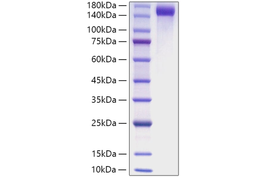 SDS-PAGE - Recombinant Mouse CD163 Protein (C-terminal His Tag) (A330244) - Antibodies.com