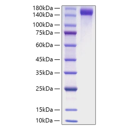 SDS-PAGE - Recombinant Mouse CD163 Protein (C-terminal His Tag) (A330244) - Antibodies.com