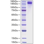SDS-PAGE - Recombinant Mouse CD163 Protein (C-terminal His Tag) (A330244) - Antibodies.com