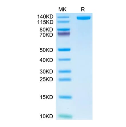 Tris-Bis PAGE - Recombinant Human CD163 Protein (C-terminal His and Avi Tag) (A330245) - Antibodies.com