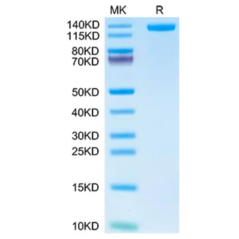 Tris-Bis PAGE - Recombinant Human CD163 Protein (C-terminal His and Avi Tag) (A330245) - Antibodies.com