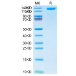 Tris-Bis PAGE - Recombinant Human CD163 Protein (C-terminal His and Avi Tag) (A330245) - Antibodies.com