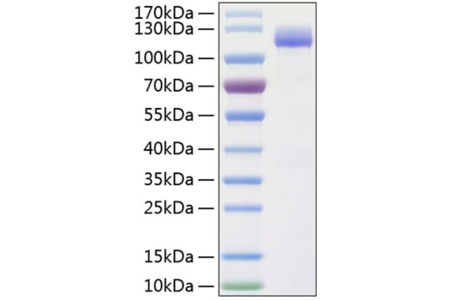 SDS-PAGE - Recombinant Human CD166 Protein (C-terminal Human Fc and His Tag) (A330246) - Antibodies.com