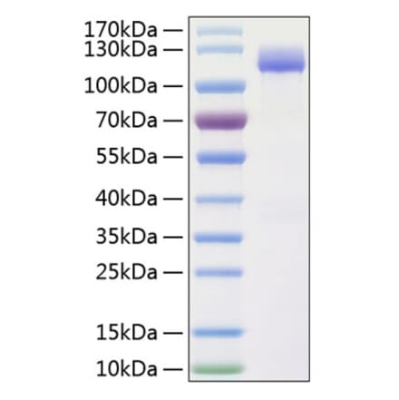 SDS-PAGE - Recombinant Human CD166 Protein (C-terminal Human Fc and His Tag) (A330246) - Antibodies.com