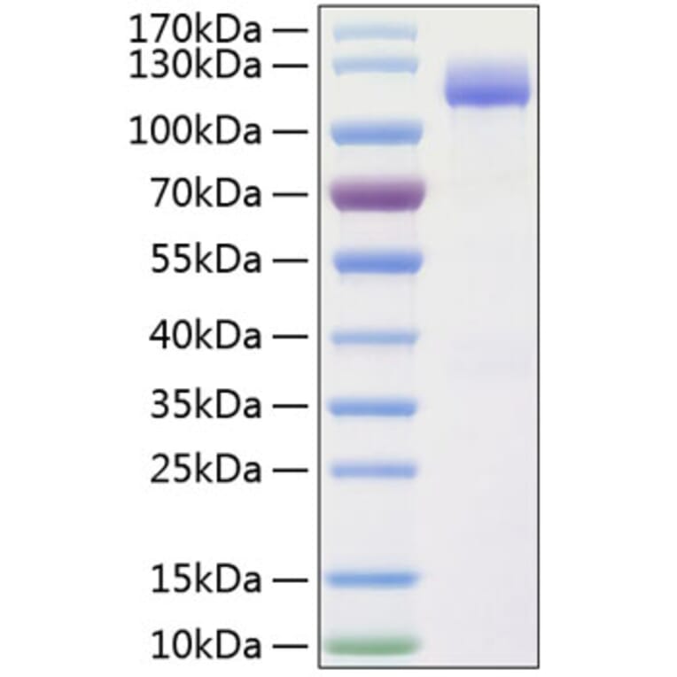 SDS-PAGE - Recombinant Human CD166 Protein (C-terminal Human Fc and His Tag) (A330246) - Antibodies.com