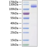 SDS-PAGE - Recombinant Human CD166 Protein (C-terminal Human Fc and His Tag) (A330246) - Antibodies.com