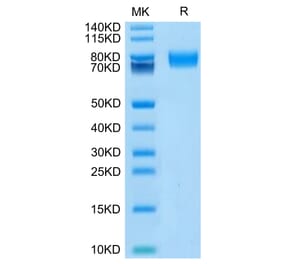 Tris-Bis PAGE - Recombinant Human CD166 Protein (Biotin) (C-terminal His and Avi Tag) (A330247) - Antibodies.com