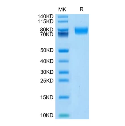 Tris-Bis PAGE - Recombinant Human CD166 Protein (Biotin) (C-terminal His and Avi Tag) (A330247) - Antibodies.com